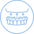 Illustration of all-on-four dental implants