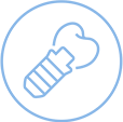Illustration of a Dental Implant
